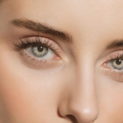 Augen einer schönen Frau nach Augenlidstraffung einer Ptosis.